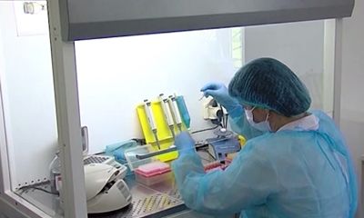 О геморрагической лихорадке с почечным синдромом предупредили в Роспотребнадзоре Ярославля