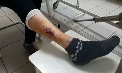 Укусы и раны: ярославцы жалуются на агрессивных бездомных собак