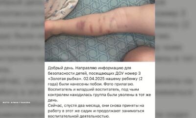 Жительница Ростова Великого сообщила об избиении 2-годовалого сына в детском саду