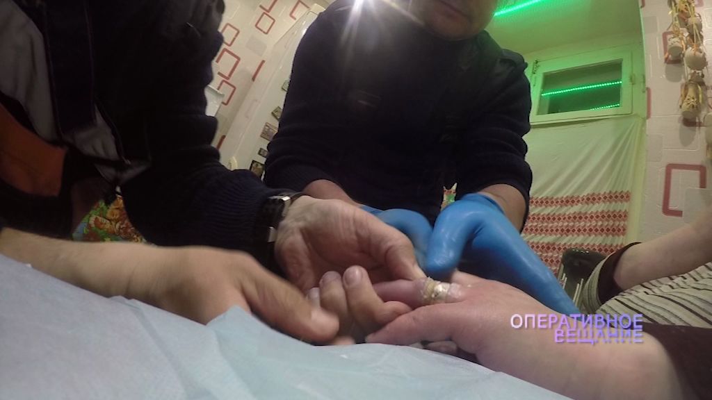 Необычный вызов: специалисты ЦГЗ спасли женщину от ювелирного украшения